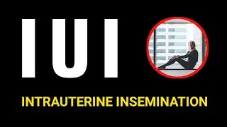 IUI | IUI Procedure | Intrauterine Insemination | Viv Care
