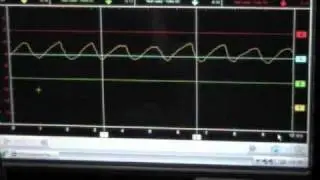 Lab Scope Testing