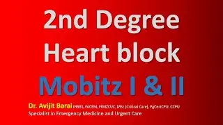 #AskDrBarai: 2nd Degree Heart block II Second Degree AV Block II ECG Made Super Easy
