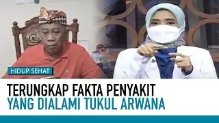 Kondisi Terkini Tukul Arwana, Begini Penjelasan Dokter