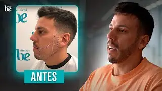 TRANSFORMACIÓN IMPRESIONANTE: Injerto de Barba en Clínicas Be | Antes y Después Salva 🌟