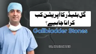 Gallbladder Stones Surgery Kab Karni Chahiye? | Dr Kamran Zaib | Laparoscopic Surgeon Lahore