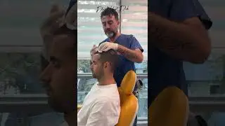 Prp tedavisi, saç dökülmelerinizin önüne geçer ve saç büyümemizi teşvik eder.✨ #drnihatdik #prp