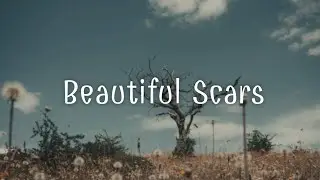 《我不會隱藏這些美麗的傷疤》Maximillian - Beautiful Scars  中英字幕 ∥ 西洋歌曲推薦 #61