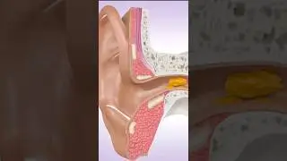 how earwax builds up animation