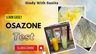 Osazone Test for Carbohydrates//Oazone formation biochemistry @MLTclass #viral #osazone