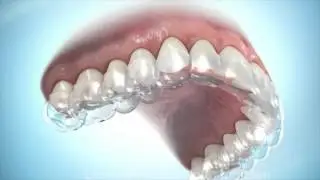 Clear Retainer