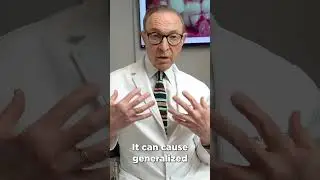 TRENCH MOUTH - What is it? How To Treat it!