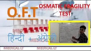 O.F.T || OSMATIC FRAGILITY TEST || 