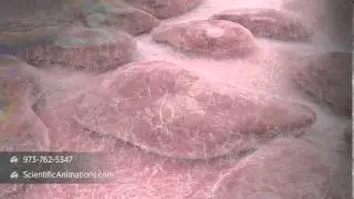 Myocyte cells - Atrial Fibrillation Treatment
