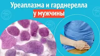 😟 Уреаплазма и гарднерелла у мужчины. Клинический случай №1222