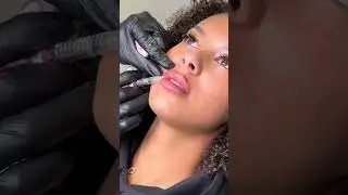 lip filler process #lipfiller #lipfillerprocess #lipsfiller #russianlipfiller