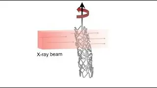 Investigation on the bioresorbable coronary scaffold resorption in-vivo
