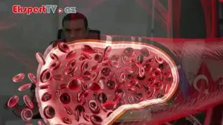 Qaraciyər sirrozunun ilkin əlamətləri nələrdir?