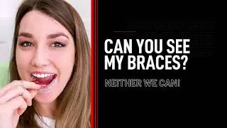 Teeth straightening with Invisible dental aligners