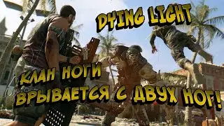 Обновление Dying light enhanced edition |  Клан ногИ 5