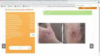 https   campusvirtual cancer gov co mod scorm player php a=708&currentorg=&scoid=10526&sesskey=LMzvd