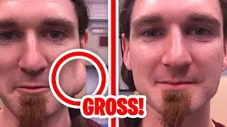 The GROSSEST & MOST DISGUSTING Moments form Dr. Pimple Popper!