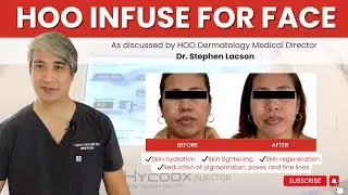 HYCOOX MULTI SUCTION INJECTOR SKIN BOOSTER TREATMENT