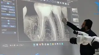 SLOB rule technique X_ray  ( mesial shift Vs Distal shift)