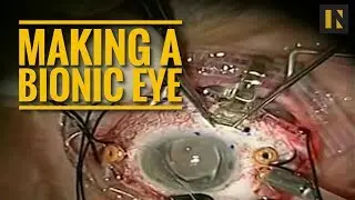 Making A Bionic Eyeball | Inverse