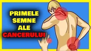 ALARMANT! DACĂ AI ACESTE SEMNE AR PUTEA FI ÎNCEPUTUL CANCERULUI, DESPRE CARE ÎNCĂ NU BĂNUIEȘTI!