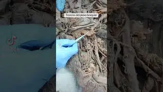 Los troncos del plexo braquial