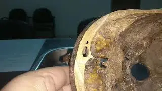 Cranial Nerves' Journey Through human Skull Foramens
