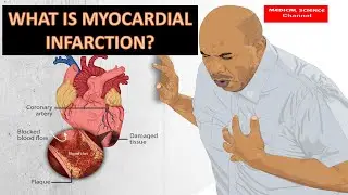 how does myocardial infarction occur? what is myocardial infarction ?(made easy)
