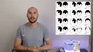 How Bald Are You? The Norwood Hamilton Scale - Where do you rank?