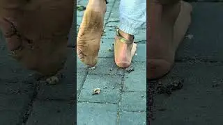 Torn tights