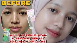 HOW TO GET RID OF DULL, OILY & ACNE SKIN VERY QUICKLY!