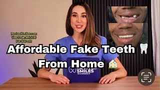 Professional Fake Teeth 🦷 From Home!!🏠
