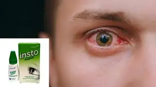 Information on Insto Regular Eye Drops to treat irritation and red eyes