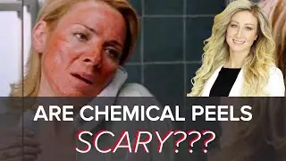 Are Chemical Peels Scary? (Expert Tells All!)