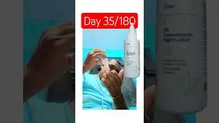 I Tried a Night Lotion for My Acne Traya Night Lotion Review