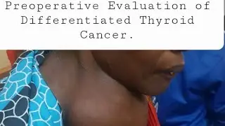 Preoperative Evaluation of Differentiated Thyroid Cancer. Part 1