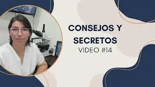 #14 CONSEJOS Y SECRETOS