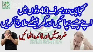 Ganje Pan Ka Ilaj sirf 15 din main, Boht Asan Nuskha