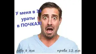 Как я выводил ураты в почках за 6 месяца.