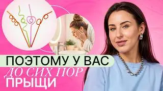 9 ОШИБОК ИЗ-ЗА КОТОРЫХ ПРЫЩИ НЕ ПРОЙДУТ НИКОГДА! ЛЕЧИМ АКНЕ базой!