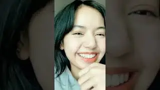 Lisa earlier being insecure about her forehead but.............