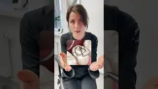 Когда пора менять пломбу (Часть 1)