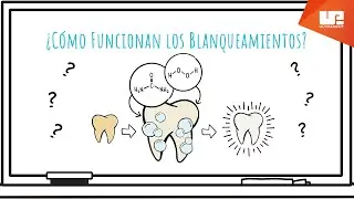 ¿Cómo Funcionan los Blanqueamientos?