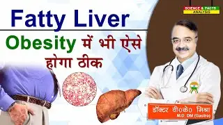 Fatty Liver || Obesity में भी ऐसे होगा ठीक || WHY OBESITY AND FATTY LIVER  ARE INTERCONNECTED