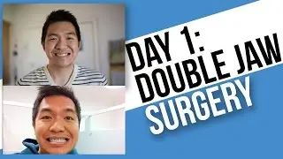 Day 1: Jaw Surgery Pre-Op, My thoughts