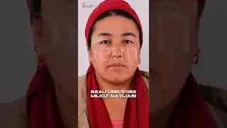 Yuzimdagi toshmalardan halos boʻldim 
