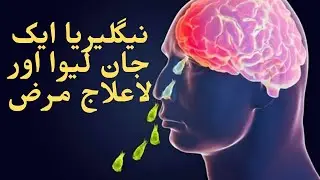 The brain-eating amoeba | An emerging threat in Karachi | How to protect