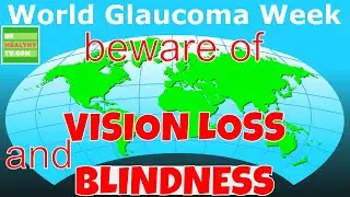GLAUCOMA,The Primary Cause of VISION LOSS and BLINDNESS