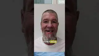 He didn't want to kiss his wife because of his teeth...😢🦷 #3on6 #newsmile #smilemakeover